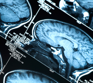 medical imaging